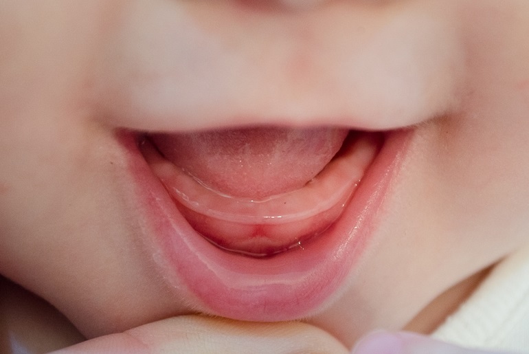 Первые зубы картинки для детей   фото011