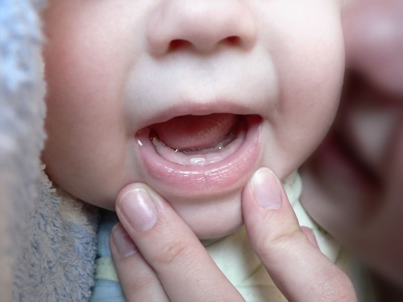 Первые зубы картинки для детей   фото015