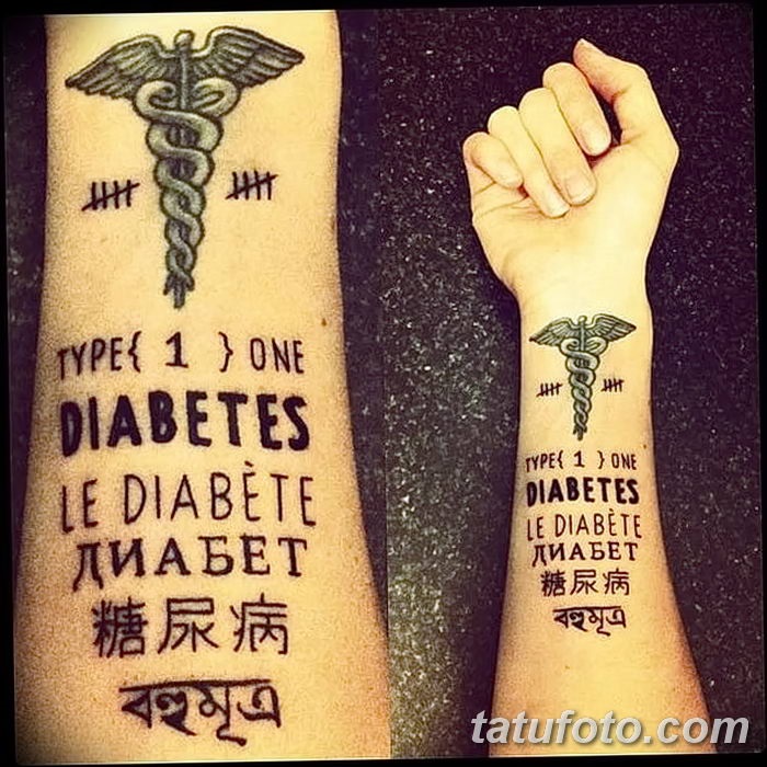 Татуировки на руке диабет