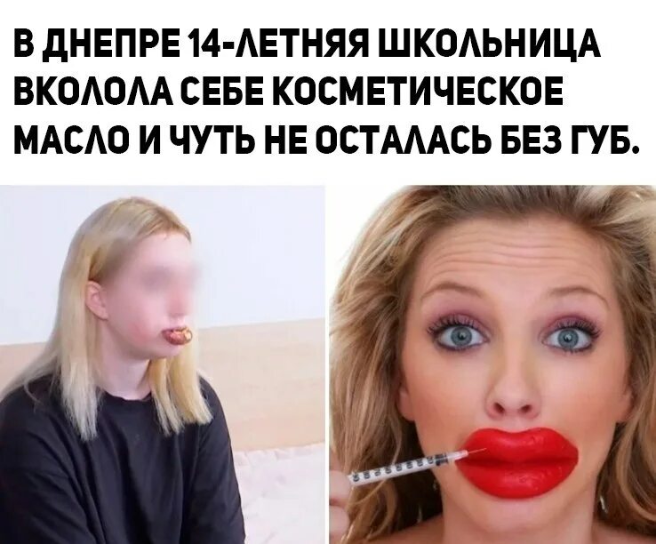 Накаченные губы смешные картинки